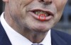 澳大利亚前总理参加反同性婚姻活动 遭“铁头功”顶伤
